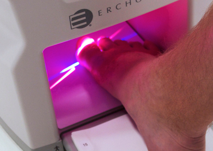 Lunula-foot-cold-laser