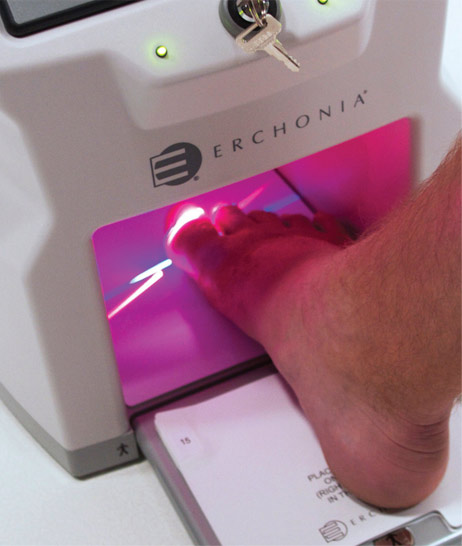 Lunula Laser treatment for fungal nail infections