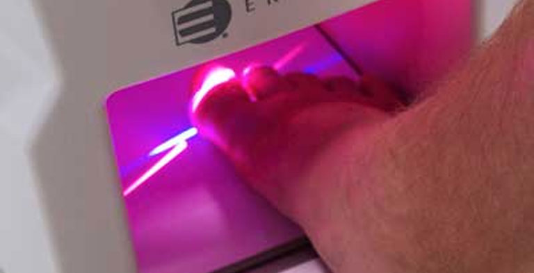 Treat toe nail fungus with Cold Laser