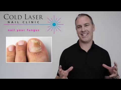 Lunula Laser Treatment for Toenail Fungus | Weil Foot & Ankle Institute